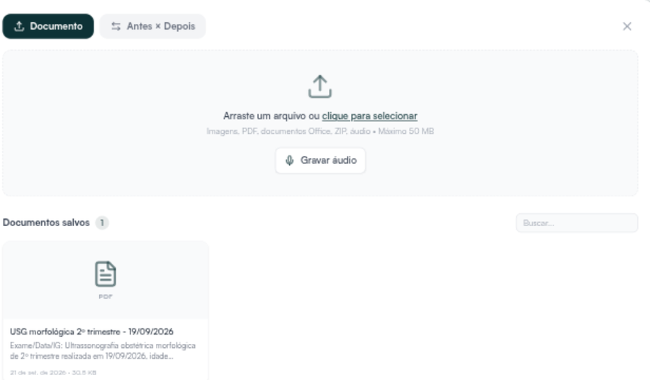 Área de Anexos com a aba Documento, o espaço para arrastar o arquivo e os documentos salvos